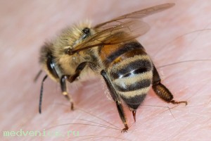 Что делать при укусе пчел